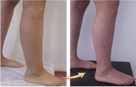 Resultado de Ana, 45 anos